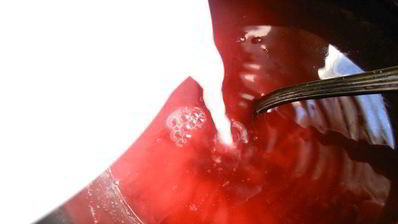 сладкий суп из ревеня с клецками